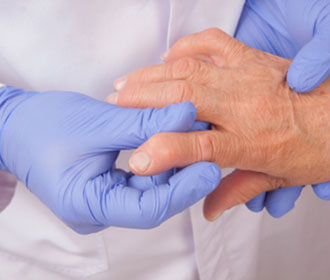 Close Up of a Medical Professional Holding a Person's Swollen Hand