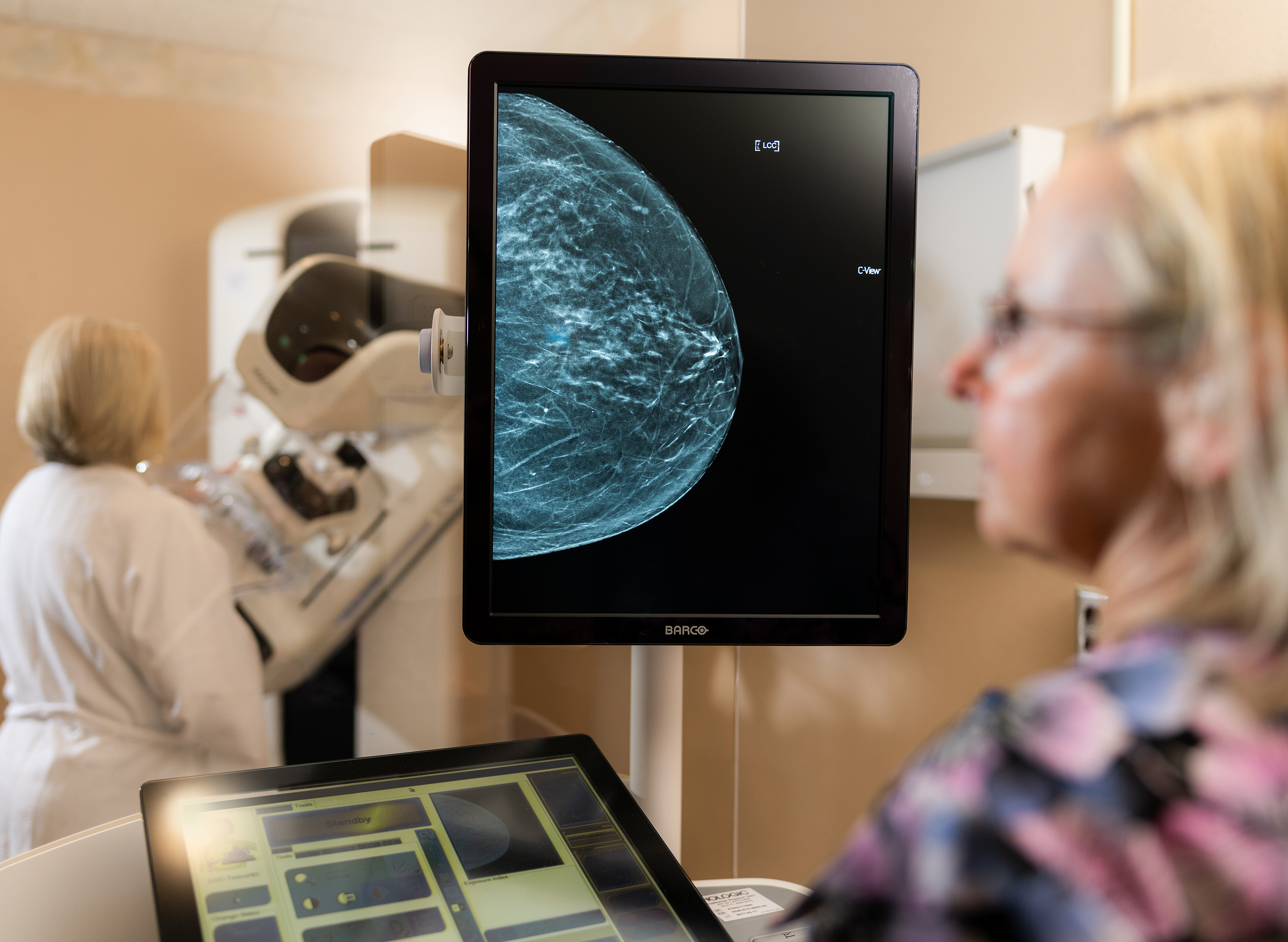 3D Mammogram